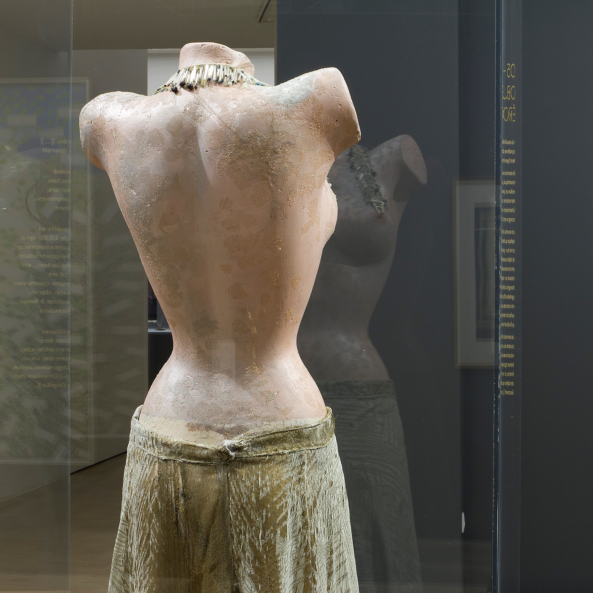 Œuvre représentant un buste sans bras, réaliste. 